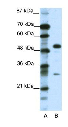 GCM1 antibody