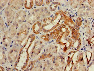GCM2 Antibody