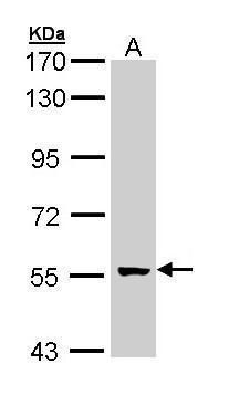 GCM2 antibody [N3C3]