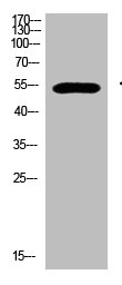 GCM2 antibody