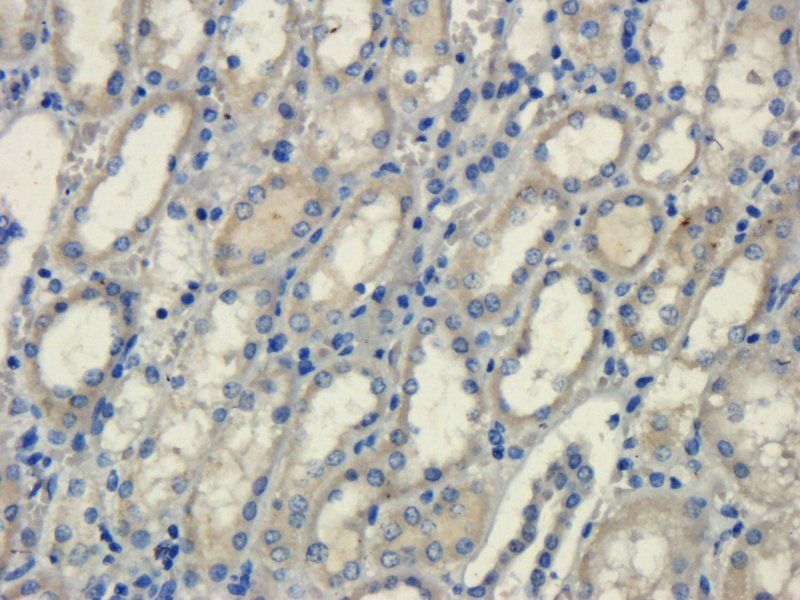 GCN2 Rabbit Polyclonal Antibody
