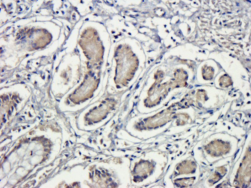 GCN2 Rabbit Polyclonal Antibody