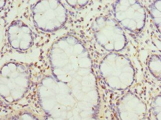 GCNT2 Antibody