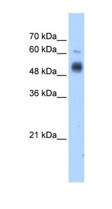GCNT3 antibody