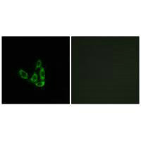 GCNT3 Antibody