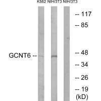 GCNT6 antibody