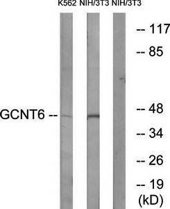 GCNT6 antibody