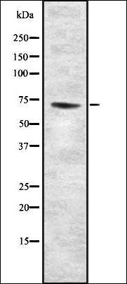 GCS- beta -2 antibody