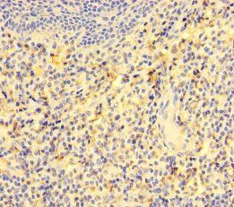 GCSAM Antibody
