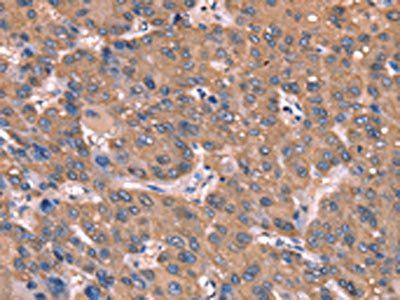 GCSAM Antibody