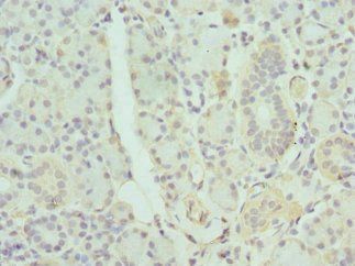 GDA Antibody