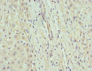 GDA Antibody