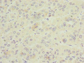 GDAP1 Antibody