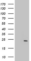 GDAP1L1 antibody