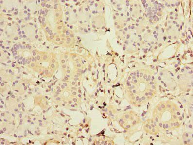 GDAP1L1 Antibody