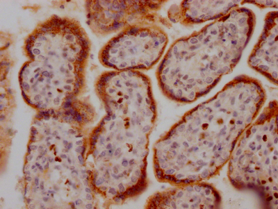 GDF15 Recombinant Monoclonal Antibody
