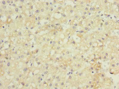 GDF2 Antibody