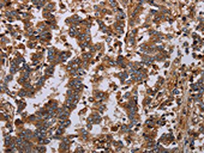 GDF2 Antibody
