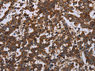GDF2 Antibody