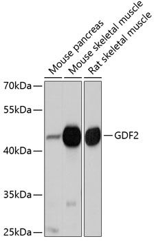 GDF2 antibody