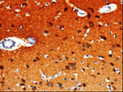 GDI1 Antibody