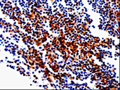 GDI1 Antibody