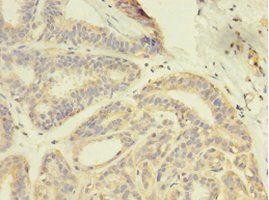 GDI2 Antibody
