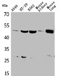 GDI2 antibody