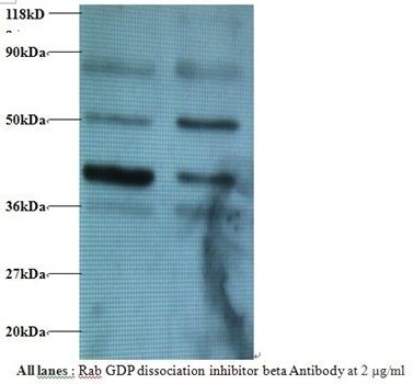 GDP dissociation inhibitor beta antibody