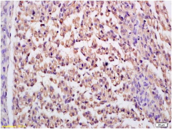 GDE3 Rabbit Polyclonal Antibody