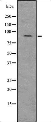 Gelsolin antibody