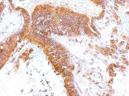 GEM Rabbit Polyclonal Antibody