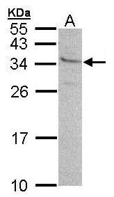 GEM Rabbit Polyclonal Antibody