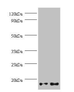 Gem-associated protein 7 antibody