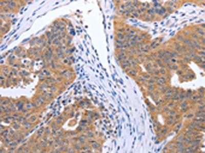 GEMIN2 Antibody