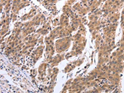 GEMIN2 Antibody