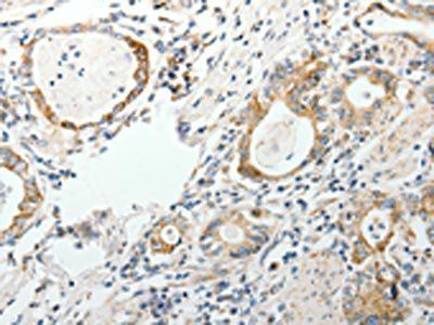GEMIN2 Antibody