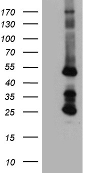 Genethonin 1 (STBD1) antibody