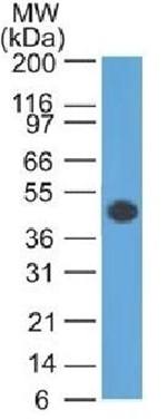 GFAP Antibody