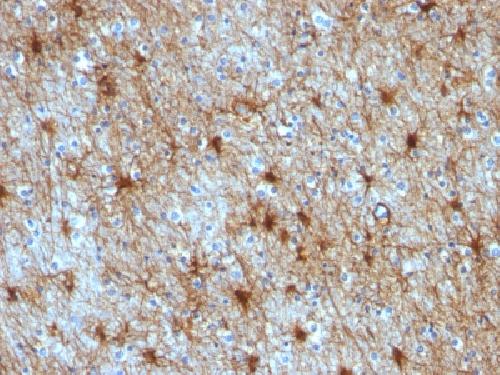 GFAP (Astrocyte & Neural Stem Cell Marker) Antibody