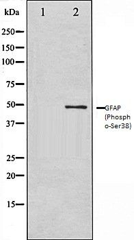 GFAP (Phospho-Ser38) antibody