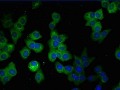 GFAP Monoclonal Antibody