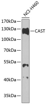CAST antibody