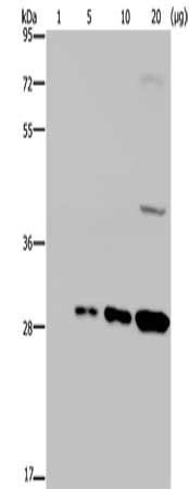 GFP antibody