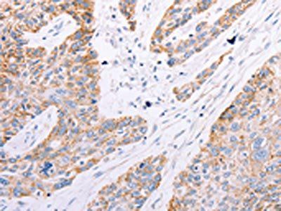 GFRA3 Antibody