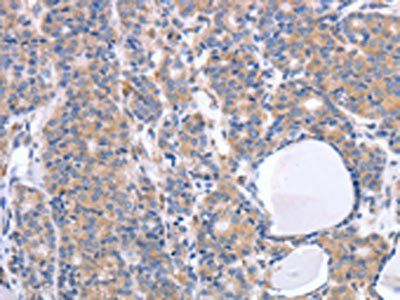 GFRA4 antibody