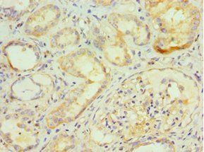 GGA2 Antibody