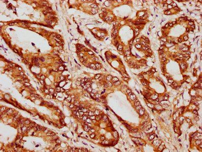 GGCT Antibody