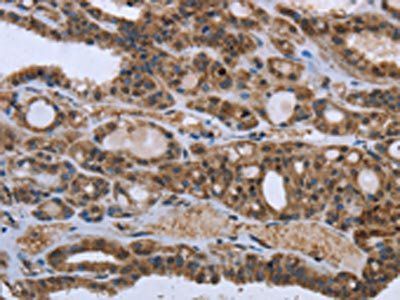 GGCX Antibody