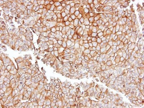 GGT1 antibody